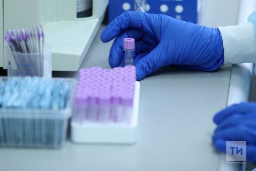 В РТ в снятых с людей клещах возбудителя вирусного энцефалита не выявлено