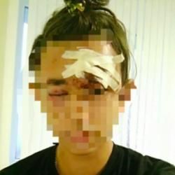 Школьника в Татарстане «избили из-за прически»