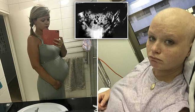 Мать 2 детей думала, что снова беременна. Но «то», что она родила, шокировало весь мир…