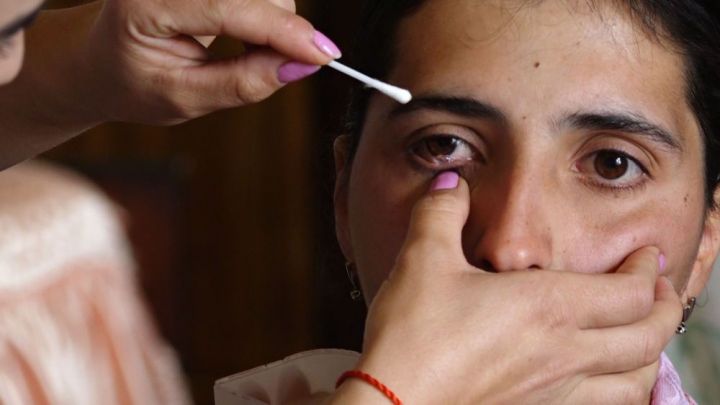 В Армении врачи не могут разгадать, почему из глаза женщины выделяются кристаллы
