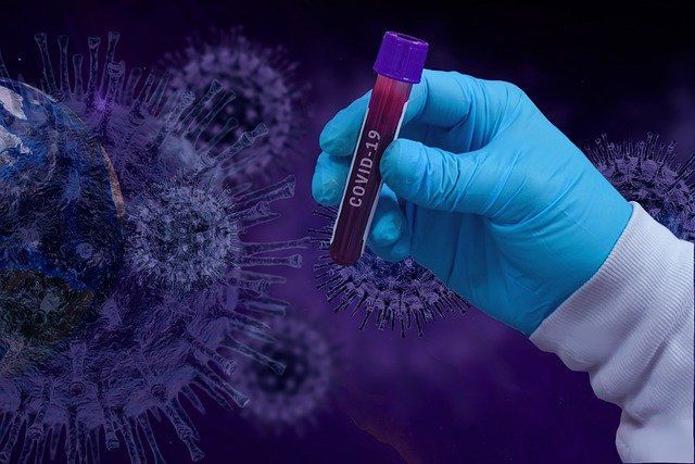 В Роспотребнадзоре спрогнозировали пик заболеваемости коронавирусом в России
