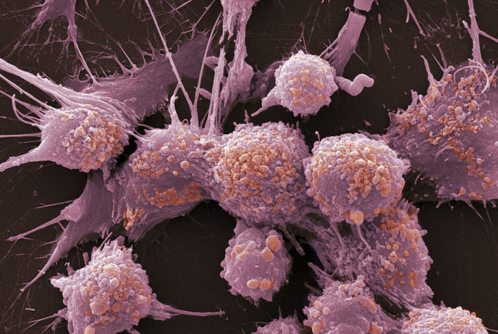 Открыт новый класс веществ, замедляющих рост раковых клеток