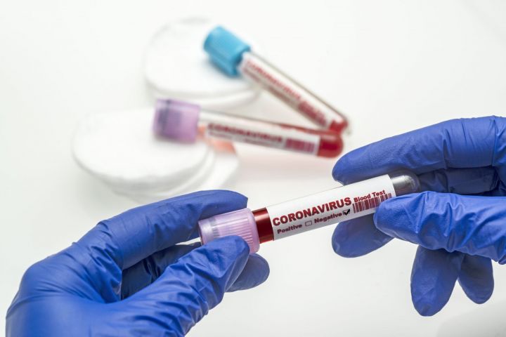 Татарстанда Covid-19 коронавирусына 24 мең тест үткәрелгән