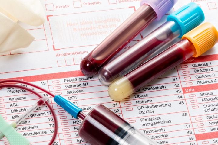 В Роспотребнадзоре объяснили, какие болезни можно выявить по анализу крови