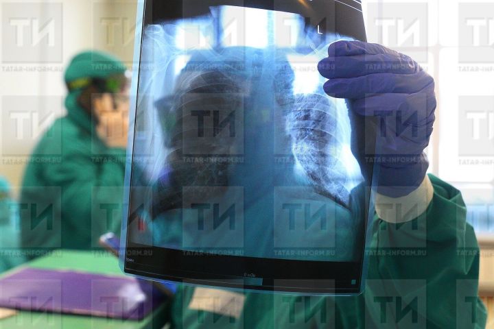 Онкологи Татарстана лечат рак легких 4D-лучами