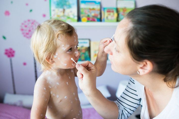 Можно ли гулять и появляться в общественных местах с ребенком, болеющим ветрянкой