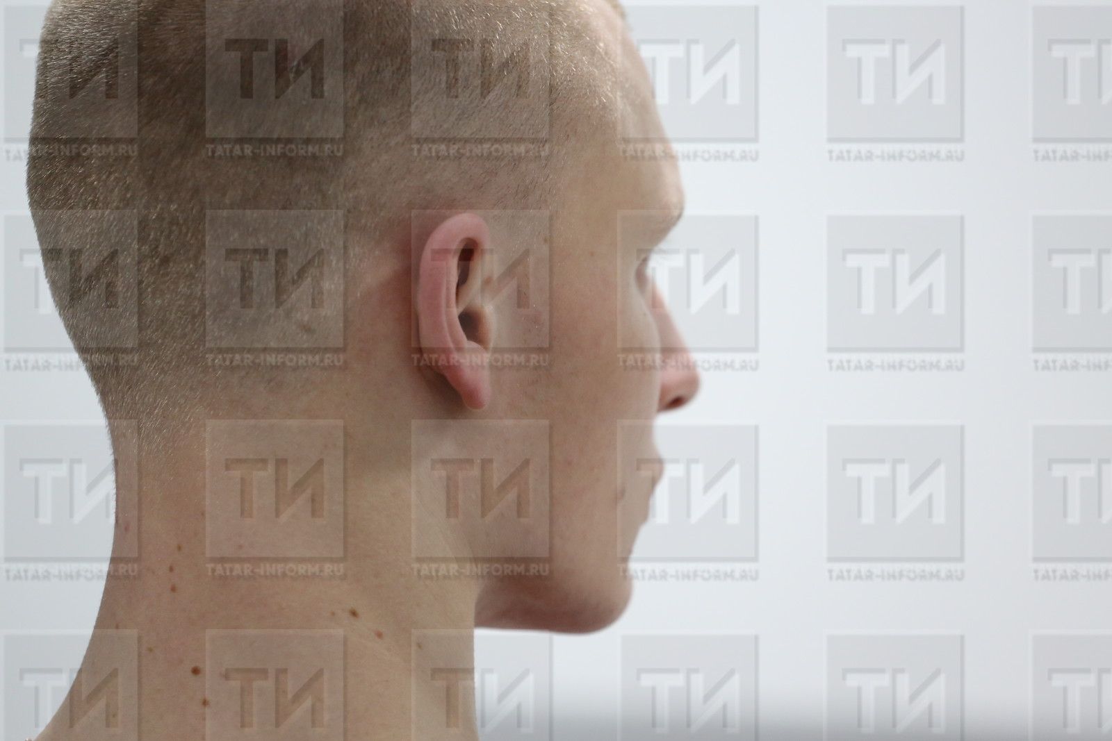 Хондроздан интегүчеләргә