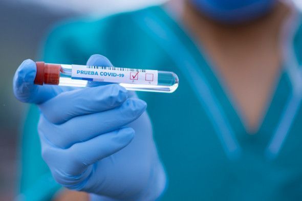 За сутки в Татарстане выявили 42 случая заражения коронавирусом