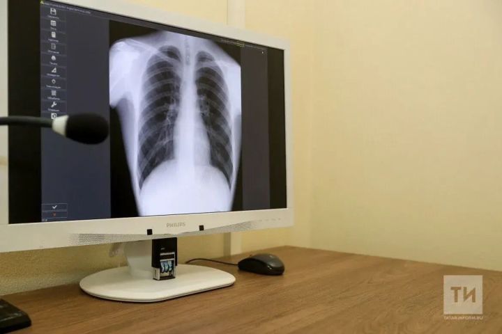 Бавлинская ЦРБ информирует о смене графика работы диагностических кабинетов